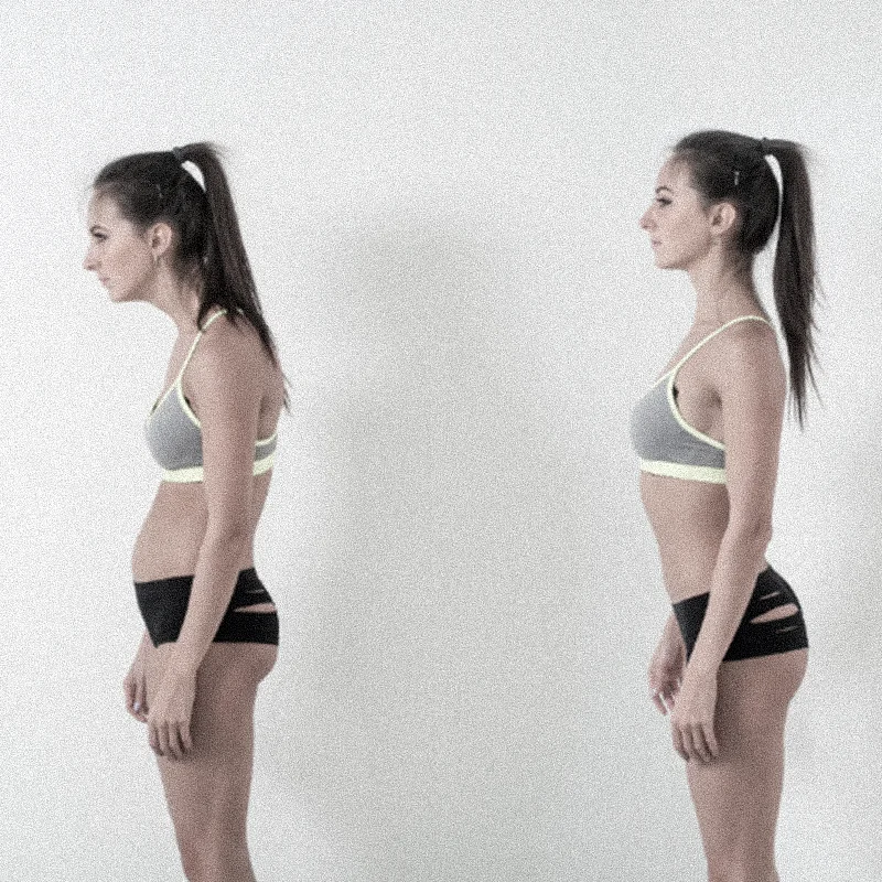 Correção postural na coluna vertebral